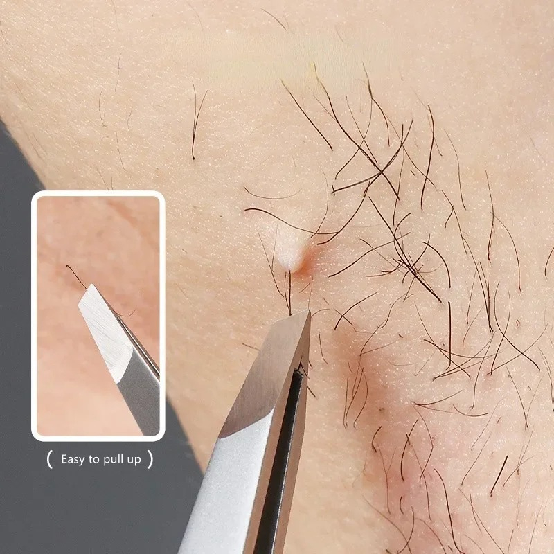 الفولاذ المقاوم للصدأ المائل ا - مراجعة Eyelash Extension For No Eyelid وسعره