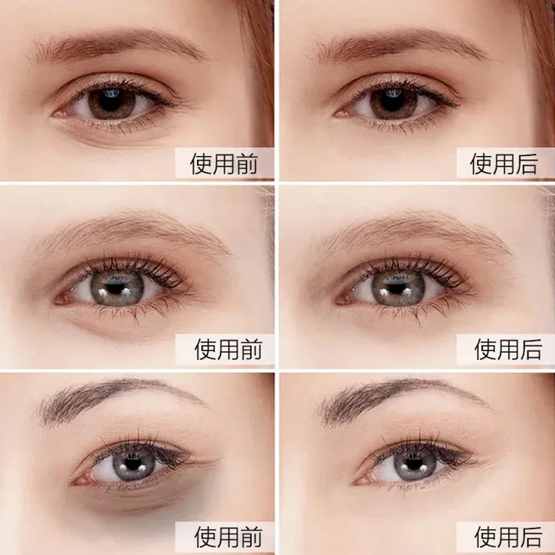 5 زوج الذهب قناع عين بقع كريست - مراجعة Eye Pad Collagen وسعره